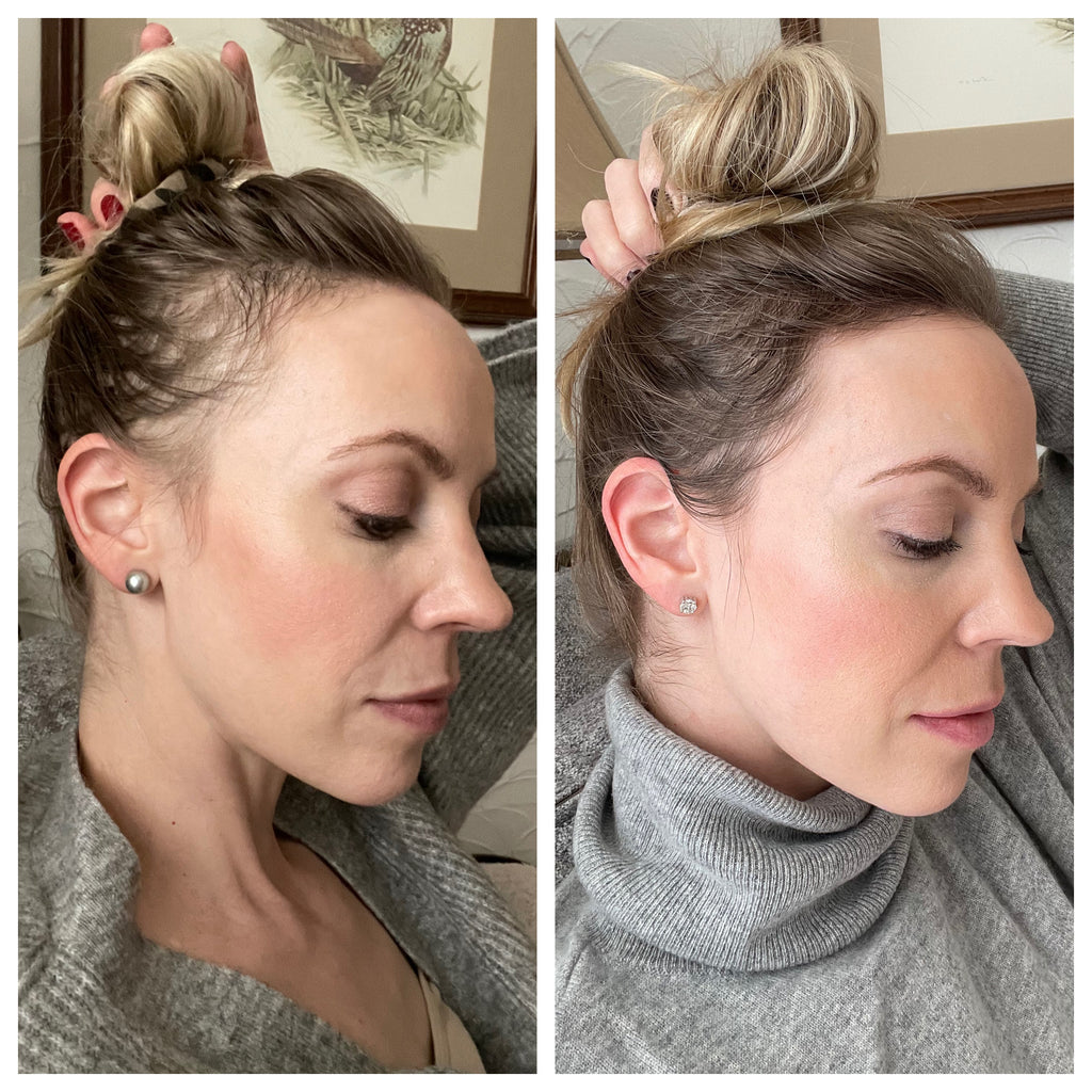 EverRoot Roll-on Hair Growth Serum
