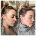 EverRoot Roll-on Hair Growth Serum